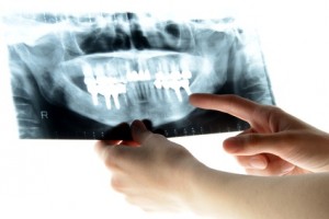 Fotolia_63917829_XS