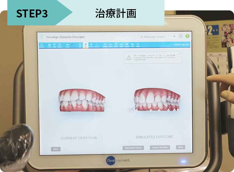 治療計画