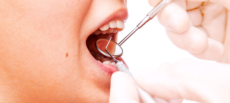 予防歯科は歯の健康を保つためには不可欠です！