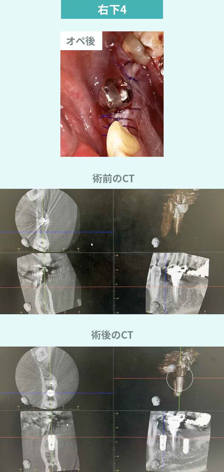 症例