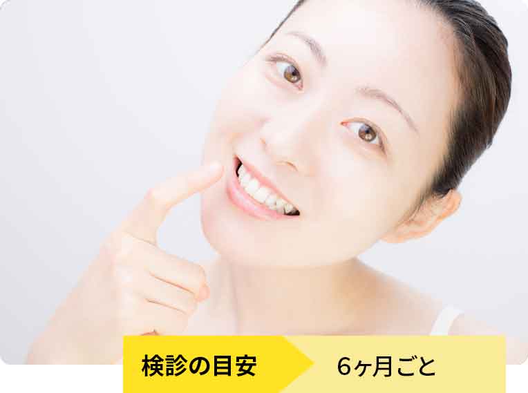 補綴物(詰め物、被せ物)のメインテナンス