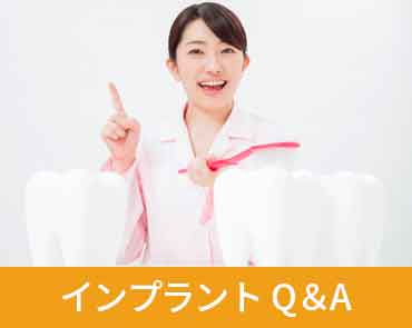 インプラントQ＆A