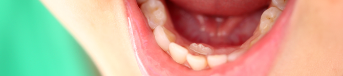 まだ乳歯が抜けてないのに…先に“永久歯”が生えてきた時の対処法！